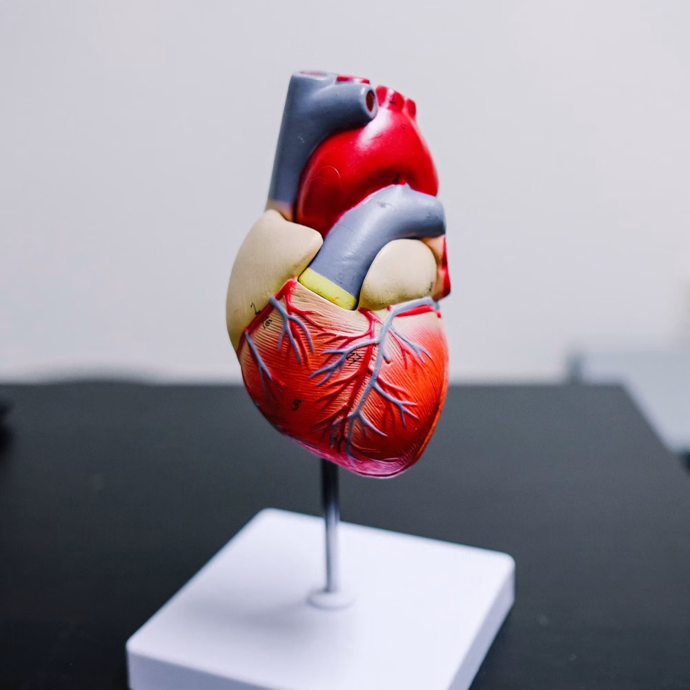 כולסטרול גבוה